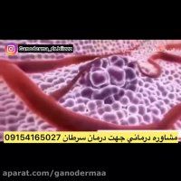 شروع دوباره زندگي با قهوه گانودرما و تاثير ان برسرطان٠٩١٥٤١٦٥٠٢٧