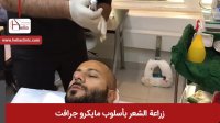 زراعه الشعر بطریقه مایکرو جرافت | عیاده هلیا | 00989120234708