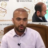 نظرات مراجعین کاشت مو