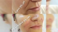 آموزش prp آموزش پی آر پی مجازی یا حضوری و انجام کار 09357790061