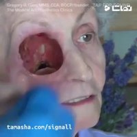 نگاهی نزدیک به پروتز های مصنوعی بدن، ترسناک نیست؟