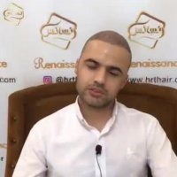 کاشت مو با متد جدید