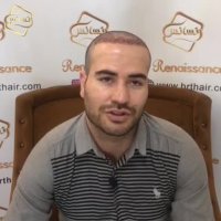 کاشت مو | کلینیک تخصصی رنسانس  02122088210