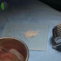 جراحی بینی ترمیمی با سابقه دوبار جراحی بینی | دکتر باستانی نژاد