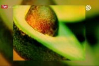 دکتر امیرحسین سربازی / متخصص پروتزهای دندانی