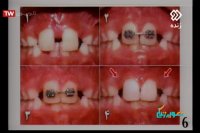 دکتر مسعود داودیان / متخصص ارتودنسی