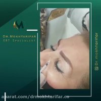 فیلم تزریق بوتاکس