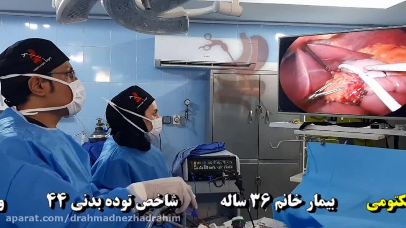 مینی بای پس و کوله سیستکتومی