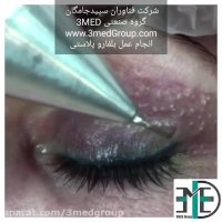 پلاسما فن آوران سپیدجامگان