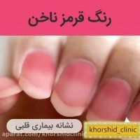 نشانه شناسى ناخن ها