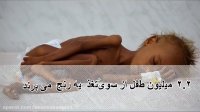 ویدیو معرفی: "اطفال یمن: قربانیان جنگ فراموش شده"