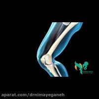 فیلم کوتاه حرکت زانو و فشاری که به عضلات ران وارد می شود