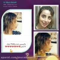 بهترین جراحی زیبایی بینی