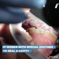 خداحافظی با مته های دندانپزشکی!