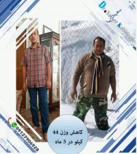 قبل و بعد عمل جراحی چاقی توسط دکتر یاسر کبیری زاده