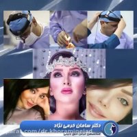 نمونه عمل بینی