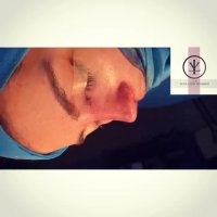 فیلم جراحی بینی فانتزی