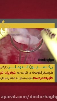 رزکسیون اندومتر