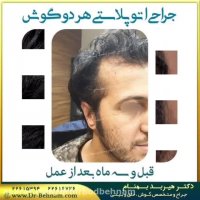 فیلم عمل جراحی زیبایی گوش