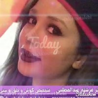 نمونه کار جراحی بینی