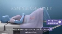 ویروس پاپیلومای انسانی (HPV) و سرطان رحم (https://hpvdarman.com/)