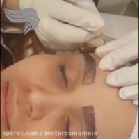 کاشت ابرو به روش طبیعی