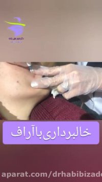 خالبرداری با آر اف