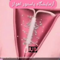 پیشگیری از بارداری