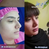 فیلم جراحی زیبایی بینی