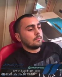 نمونه جراحی بینی