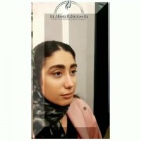 عمل بینی بدون درد!!!!