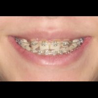 ارتودنسی  ایمپلنت و زیبایی | دکتر داودیان