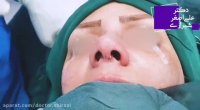 فیلم واقعی از جراحی بینی گوشتی