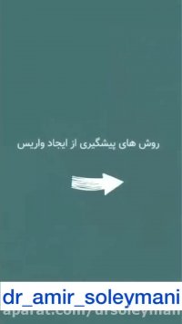 واریس را جدی بگیرید