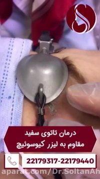 فیلم واقعی پاک کردن تتو