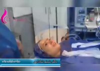 فیلم عمل جراحی زیبایی بینی
