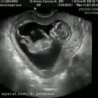 سونوگرافی دوران بارداری