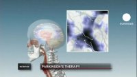 درمان جدید علایم بیماری پارکینسون را کاهش می دهد