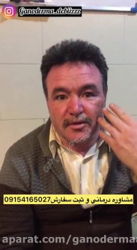 احيا و توليد رنگدانه هاي پوستي با دارو...09154165027