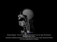 تصویربرداری MRI از یک خواننده