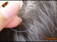 دلایل سفید شدن مو در جوانی