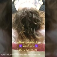 درمان ریزش موی جلوی سر خانمها