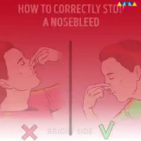 چگونه بطور صحیح خونریزی بینی را بند بیاوریم؟