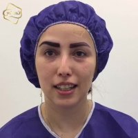 کاشت ابرو -کلینیک تخصصی رنسانس