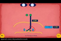 سندروم یک و نیم