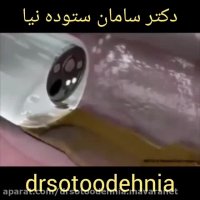 تمیز کردن روده بزرگ با کولونوسکوپی