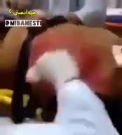 قلب در حالت انفجار