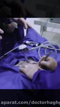 ورشات دکتوره حقکو