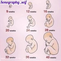 هفته به هفته ی بارداری