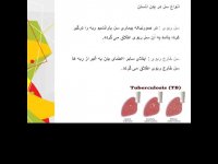 اطلاعات  بیماری سل